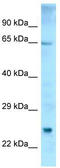 Electron transfer flavoprotein-ubiquinone oxidoreductase, mitochondrial antibody, TA342825, Origene, Western Blot image 