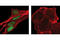 SNAI2 antibody, 9585T, Cell Signaling Technology, Immunofluorescence image 