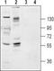 Neurotrophic Receptor Tyrosine Kinase 2 antibody, TA328906, Origene, Western Blot image 