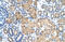 Cytosolic inhibitor of Nrf2 antibody, ARP34728_T100, Aviva Systems Biology, Immunohistochemistry paraffin image 