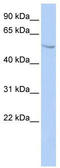 SUFU Negative Regulator Of Hedgehog Signaling antibody, TA331926, Origene, Western Blot image 