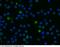 Leukocyte Immunoglobulin Like Receptor B3 antibody, 50760-R058, Sino Biological, Immunohistochemistry paraffin image 