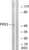 Fibroblast Growth Factor Receptor Substrate 3 antibody, TA315111, Origene, Western Blot image 
