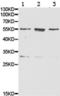 Hepatic lipase antibody, TA321090, Origene, Western Blot image 