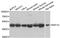 Elongation factor 1-gamma antibody, abx006746, Abbexa, Western Blot image 