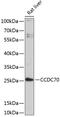 Coiled-Coil Domain Containing 70 antibody, 15-534, ProSci, Western Blot image 