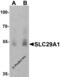 Equilibrative nucleoside transporter 1 antibody, 8125, ProSci Inc, Western Blot image 
