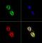 FAS antibody, GTX30468, GeneTex, Immunocytochemistry image 