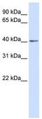 NK3 Homeobox 2 antibody, TA344471, Origene, Western Blot image 