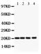 Dihydrofolate Reductase antibody, PB9175, Boster Biological Technology, Western Blot image 