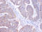 AP2S1 antibody, A51809-100, Epigentek, Immunohistochemistry paraffin image 