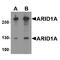 B120 antibody, TA349170, Origene, Western Blot image 