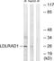 Low Density Lipoprotein Receptor Class A Domain Containing 1 antibody, GTX87041, GeneTex, Western Blot image 