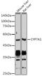 Cytochrome P450 Family 7 Subfamily A Member 1 antibody, GTX03391, GeneTex, Western Blot image 