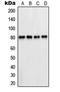 6-phosphofructokinase, liver type antibody, LS-C352646, Lifespan Biosciences, Western Blot image 