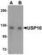Ubiquitin Specific Peptidase 10 antibody, A03786, Boster Biological Technology, Western Blot image 