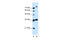 Solute Carrier Family 9 Member A7 antibody, 25-921, ProSci, Western Blot image 