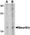 Neuritin 1 antibody, A09989, Boster Biological Technology, Western Blot image 