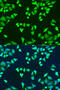 Survival Of Motor Neuron 2, Centromeric antibody, 14-470, ProSci, Immunofluorescence image 