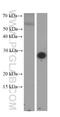 C-Reactive Protein antibody, 66250-1-Ig, Proteintech Group, Western Blot image 