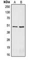 Corticotropin Releasing Hormone Receptor 2 antibody, orb213781, Biorbyt, Western Blot image 
