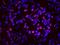 Splicing Factor 3a Subunit 1 antibody, IHC-00316, Bethyl Labs, Immunohistochemistry paraffin image 