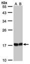 Heat shock protein beta-8 antibody, TA308596, Origene, Western Blot image 