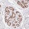 Zinc Finger Protein 80 antibody, NBP2-38068, Novus Biologicals, Immunohistochemistry paraffin image 