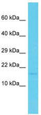 PDZ Domain Containing 11 antibody, TA331912, Origene, Western Blot image 