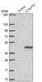 Chromosome 16 Open Reading Frame 72 antibody, NBP1-93773, Novus Biologicals, Western Blot image 