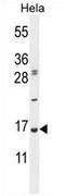 Ubiquitin A-52 Residue Ribosomal Protein Fusion Product 1 antibody, AP54434PU-N, Origene, Western Blot image 