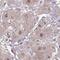 Retinol Dehydrogenase 14 antibody, HPA056686, Atlas Antibodies, Immunohistochemistry paraffin image 
