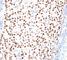 Progesterone Receptor antibody, V2225-100UG, NSJ Bioreagents, Immunohistochemistry frozen image 