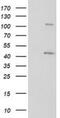 PKA regulatory subunit I beta antibody, NBP2-00634, Novus Biologicals, Western Blot image 