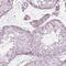Keratin, type I cytoskeletal 28 antibody, PA5-66878, Invitrogen Antibodies, Immunohistochemistry paraffin image 