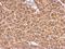 Protein Kinase C Substrate 80K-H antibody, GTX101856, GeneTex, Immunohistochemistry paraffin image 