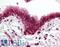 SKI Like Proto-Oncogene antibody, LS-B2062, Lifespan Biosciences, Immunohistochemistry paraffin image 
