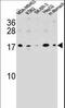 S100 Calcium Binding Protein Z antibody, LS-C162834, Lifespan Biosciences, Western Blot image 