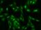 Spermatogenesis Associated 5 Like 1 antibody, 205660-T02, Sino Biological, Immunohistochemistry paraffin image 