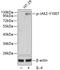 Janus Kinase 2 antibody, A00027Y1007, Boster Biological Technology, Western Blot image 