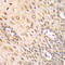 Proteasome Subunit Alpha 2 antibody, LS-C332124, Lifespan Biosciences, Immunohistochemistry paraffin image 