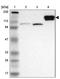 Hephaestin antibody, NBP1-85483, Novus Biologicals, Western Blot image 