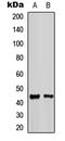Potassium Voltage-Gated Channel Subfamily J Member 11 antibody, LS-C356142, Lifespan Biosciences, Western Blot image 
