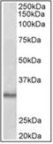 SCP1 antibody, AP31837PU-N, Origene, Western Blot image 