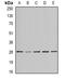 B Cell Receptor Associated Protein 29 antibody, abx141842, Abbexa, Western Blot image 