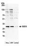 Ribosome maturation protein SBDS antibody, A305-018A, Bethyl Labs, Western Blot image 