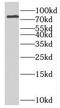 Inturned Planar Cell Polarity Protein antibody, FNab04367, FineTest, Western Blot image 