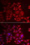 Lymphotactin antibody, abx004902, Abbexa, Western Blot image 