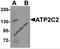 ATPase Secretory Pathway Ca2+ Transporting 2 antibody, 6289, ProSci, Western Blot image 