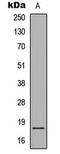 Synuclein Alpha antibody, LS-C358871, Lifespan Biosciences, Western Blot image 